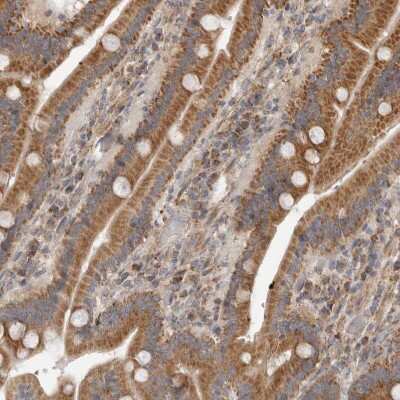 Immunohistochemistry-Paraffin: FAM54B Antibody [NBP1-86401] - Staining of human gastrointestinal shows moderate to strong cytoplasmic positivity in glandular cells.