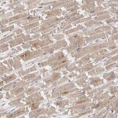 Immunohistochemistry-Paraffin: FAM54B Antibody [NBP1-86401] - Staining of human heart muscle shows weak to moderate cytoplasmic positivity in cardiomyocytes.