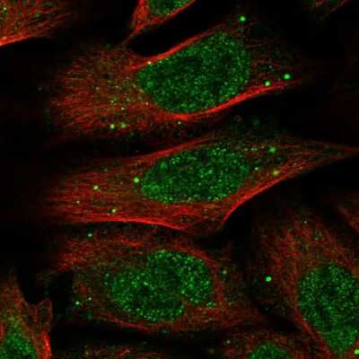 Immunocytochemistry/Immunofluorescence: FAM55C Antibody [NBP1-81192] - Immunofluorescent staining of human cell line U-2 OS shows localization to nucleoplasm & vesicles.