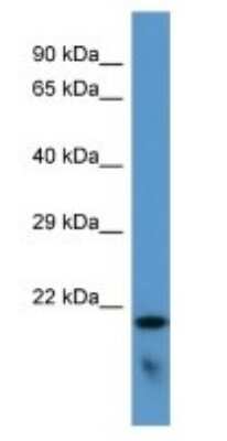 Western Blot: FAM57B Antibody [NBP3-09270] - Western blot analysis of FAM57B in Hela Whole cell lysates. Antibody dilution at 1.0ug/ml