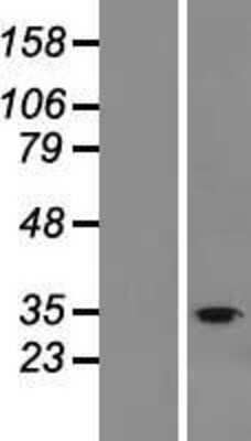 Western Blot: FAM57B Overexpression Lysate (Adult Normal) [NBL1-10545] Left-Empty vector transfected control cell lysate (HEK293 cell lysate); Right -Over-expression Lysate for FAM57B.