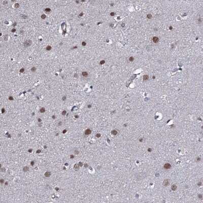 Immunohistochemistry: FAM59A Antibody [NBP2-47460] - Staining of human cerebral cortex shows moderate nuclear staining in neuronal cells