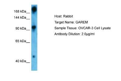 Western Blot: FAM59A Antibody [NBP2-84920] - Host: Rabbit. Target Name: GAREM. Sample Type: OVCAR-3 Whole Cell. Antibody Dilution: 1.0ug/ml