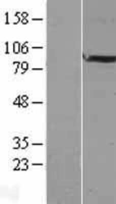 Western Blot: FAM5B Overexpression Lysate (Adult Normal) [NBL1-10547] Left-Empty vector transfected control cell lysate (HEK293 cell lysate); Right -Over-expression Lysate for FAM5B.