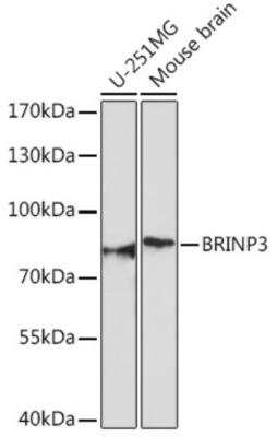 Western Blot: FAM5C Antibody [NBP2-93578] - Western blot analysis of extracts of various cell lines, using FAM5C antibody at 1:1000 dilution. Secondary antibody: HRP Goat Anti-Rabbit IgG (H+L) at 1:10000 dilution. Lysates/proteins: 25ug per lane. Blocking buffer: 3% nonfat dry milk in TBST. Detection: ECL Basic Kit. Exposure time: 90s.