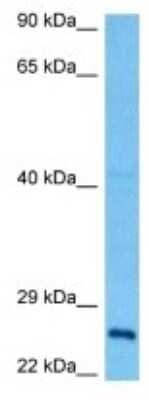 Western Blot FAM60A Antibody