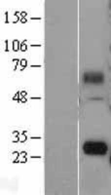 Western Blot: FAM60A Overexpression Lysate (Adult Normal) [NBL1-10548] Left-Empty vector transfected control cell lysate (HEK293 cell lysate); Right -Over-expression Lysate for FAM60A.