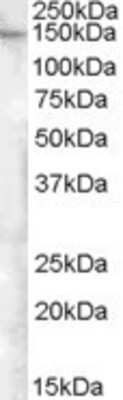 Western Blot: FAM62A Antibody [NBP1-00184] - Staining of Human Adipose lysate (35 ug protein in RIPA buffer). Antibody at 0.5 ug/mL. Primary incubation was 1 hour. Detected by chemiluminescence.