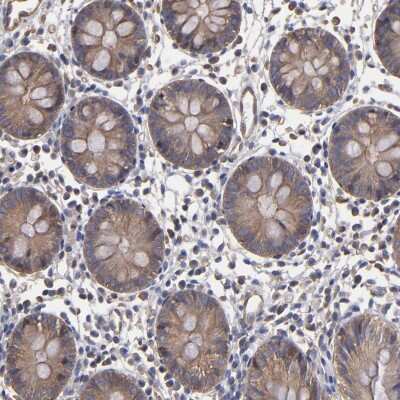 Immunohistochemistry-Paraffin: FAM62B Antibody [NBP1-85627] - Staining of human colon shows moderate cytoplasmic positivity in glandular cells.
