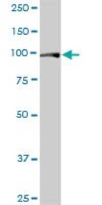 Western Blot: FAM62B Antibody [H00057488-B01P] - Analysis of FAM62B expression in human colon.