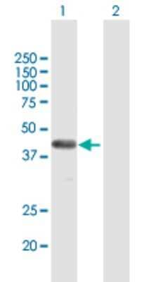 Western Blot: FAM62B Antibody [H00057488-B01P] - Analysis of FAM62B expression in transfected 293T cell line by FAM62B polyclonal antibody.  Lane 1: FAM62B transfected lysate(39.38 KDa). Lane 2: Non-transfected lysate.
