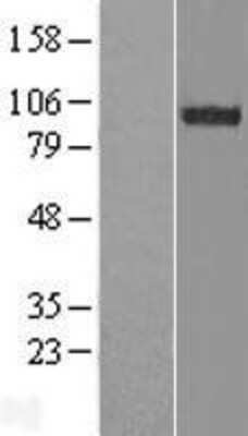 Western Blot FAM62B Overexpression Lysate