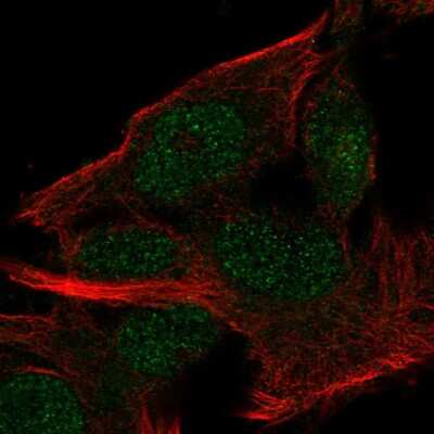 Immunocytochemistry/Immunofluorescence: FAM63B Antibody [NBP2-57857] - Staining of human cell line SK-MEL-30 shows localization to nucleoplasm.