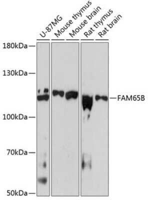Western Blot: FAM65B Antibody [NBP3-04522] - Analysis of extracts of various cell lines, using FAM65B antibody at 1:3000 dilution. Secondary antibody: HRP Goat Anti-Rabbit IgG (H+L) at 1:10000 dilution. Lysates/proteins: 25ug per lane. Blocking buffer: 3% nonfat dry milk in TBST. Detection: ECL Basic Kit