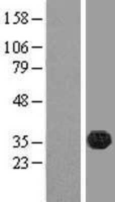 Western Blot: FAM70B Overexpression Lysate (Adult Normal) [NBL1-10557] Left-Empty vector transfected control cell lysate (HEK293 cell lysate); Right -Over-expression Lysate for FAM70B.