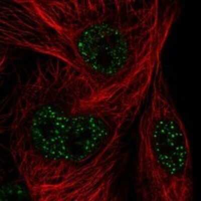 Immunocytochemistry/Immunofluorescence: FAM71A Antibody [NBP3-17366] - Staining of human cell line SuSa shows localization to nuclear speckles.
