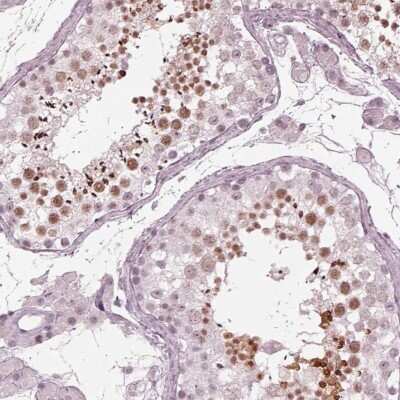 Immunohistochemistry-Paraffin: FAM71A Antibody [NBP1-83516] - Staining of human testis shows moderate nuclear positivity in seminiferous ducts.