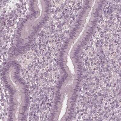 Immunohistochemistry-Paraffin: FAM71A Antibody [NBP1-83516] - Staining of human endometrium shows low expression as expected.