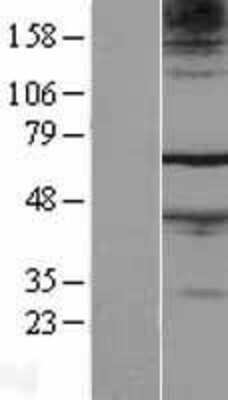 Western Blot: FAM71A Overexpression Lysate (Adult Normal) [NBL1-10558] Left-Empty vector transfected control cell lysate (HEK293 cell lysate); Right -Over-expression Lysate for FAM71A.