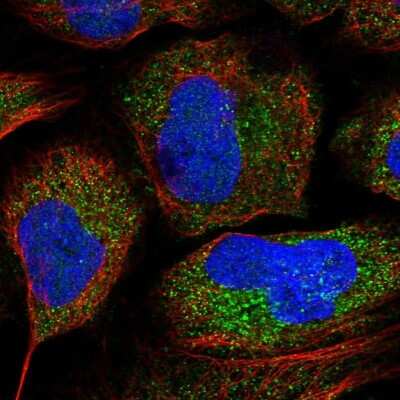 Immunocytochemistry/Immunofluorescence: FAM73B Antibody [NBP1-86701] - Staining of human cell line U-2 OS shows localization to cytosol. Antibody staining is shown in green.