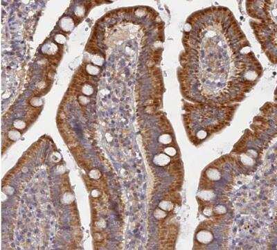 Immunohistochemistry-Paraffin: FAM73B Antibody [NBP1-86701] - Staining of human duodenum shows strong positivity in glandular cells.