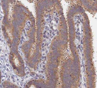 Immunohistochemistry-Paraffin: FAM73B Antibody [NBP1-86701] - Staining of human fallopian tube shows moderate positivity in glandular cells.