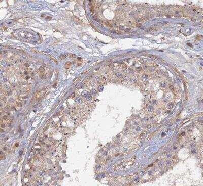 Immunohistochemistry-Paraffin: FAM73B Antibody [NBP1-86701] - Staining of human testis shows weak positivity in cells in seminiferous ducts.