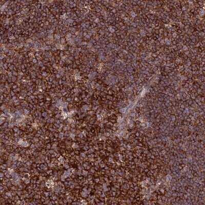 Immunohistochemistry-Paraffin: FAM76A Antibody [NBP1-81103] - Staining of human tonsil shows strong cytoplasmic positivity in germinal center cells and non-germinal center cells.