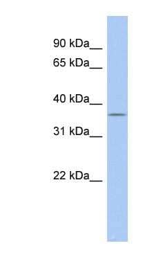 Western Blot: FAM76A Antibody [NBP1-55436] - Human kidney lysate, concentration 0.2-1 ug/ml.