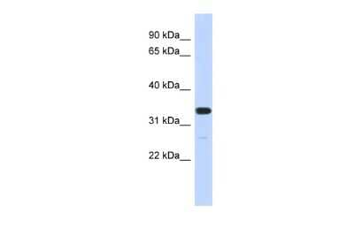 Western Blot: FAM76A Antibody [NBP3-09312] - Western blot analysis using NBP3-09312 on Human MCF-7 as a positive control. Antibody Titration: 0.2-1 ug/ml