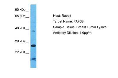 Western Blot: FAM76B Antibody [NBP2-87426] - Host: Rabbit. Target Name: FA76B. Sample Type: Breast Tumor lysates. Antibody Dilution: 1.0ug/ml