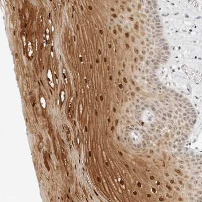 Immunohistochemistry-Paraffin: FAM80A Antibody [NBP1-87935] - Staining of human oral mucosa shows strong nuclear positivity in squamous epithelial cells.