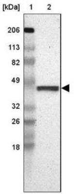 Western Blot: FAM81A Antibody [NBP2-33295] - Lane 1: Marker  [kDa] 206, 113, 82, 49, 32, 26, 18.   Lane 2: Human cell line RT-4
