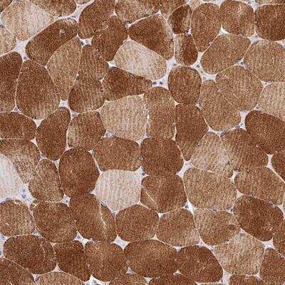 Immunohistochemistry-Paraffin FAM83E Antibody - BSA Free