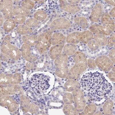 Immunohistochemistry-Paraffin FAM83E Antibody - BSA Free