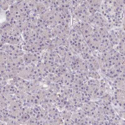 Immunohistochemistry-Paraffin FAM83E Antibody - BSA Free