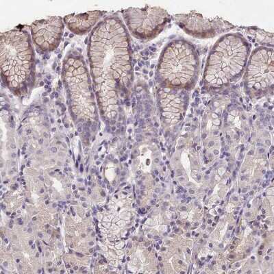 Immunohistochemistry-Paraffin FAM83E Antibody - BSA Free