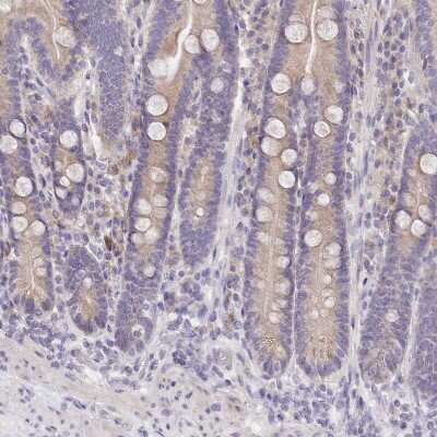 Immunohistochemistry-Paraffin FAM83E Antibody - BSA Free