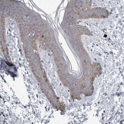 Immunohistochemistry-Paraffin FAM83H Antibody