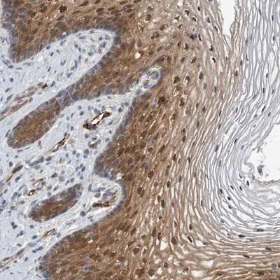 <b>Orthogonal Strategies Validation. </b>Immunohistochemistry-Paraffin: FAM83H Antibody [NBP1-93738] - Staining of human vagina shows strong cytoplasmic and nuclear positivity in squamous epithelial cells.