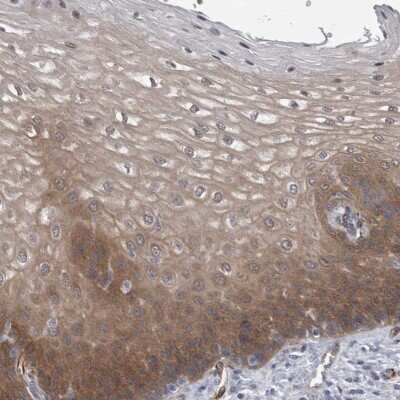 Immunohistochemistry-Paraffin: FAM83H Antibody [NBP1-93738] - Staining of human esophagus shows high expression.