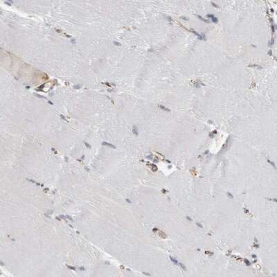 Immunohistochemistry-Paraffin: FAM83H Antibody [NBP1-93738] - Staining of human skeletal muscle shows low expression as expected.