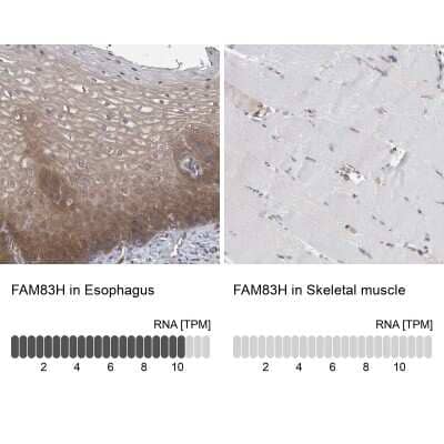 Immunohistochemistry-Paraffin: FAM83H Antibody [NBP1-93738] - Staining in human esophagus and skeletal muscle tissues using anti-FAM83H antibody. Corresponding FAM83H RNA-seq data are presented for the same tissues.