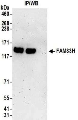 Immunoprecipitation: FAM83H Antibody [NBP2-32218] - Samples:  Whole cell lysate (0.5 or 1.0 mg per IP reaction; 20% of IP loaded) from 293T cells.  Antibodies:  Affinity purified rabbit anti-FAM83H antibody NBP2-32218 used for IP at 6 ug per reaction. For blotting immunoprecipitated FAM83H was used at 1 ug/ml.  Detection: Chemiluminescence with an exposure time of 3 minutes.