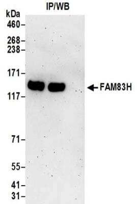 <b>Biological Strategies Validation. </b>Immunoprecipitation: FAM83H Antibody [NBP2-32219] - Samples:  Whole cell lysate (0.5 or 1.0 mg per IP reaction; 20% of IP loaded) from 293T cells. Antibodies:  Affinity purified rabbit anti-FAM83H antibody NBP2-32219 used for IP at 6 ug per reaction. For blotting immunoprecipitated FAM83H, NBP2-32219 was used at 1 ug/ml.  Detection: Chemiluminescence with an exposure time of 3 minutes.