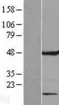 Western Blot: FAM86C Overexpression Lysate (Adult Normal) [NBL1-10579] Left-Empty vector transfected control cell lysate (HEK293 cell lysate); Right -Over-expression Lysate for FAM86C.