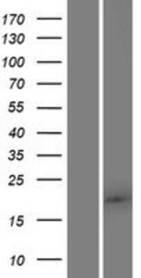 Western Blot: FAM89B Overexpression Lysate (Adult Normal) [NBP2-08329] Left-Empty vector transfected control cell lysate (HEK293 cell lysate); Right -Over-expression Lysate for FAM89B.