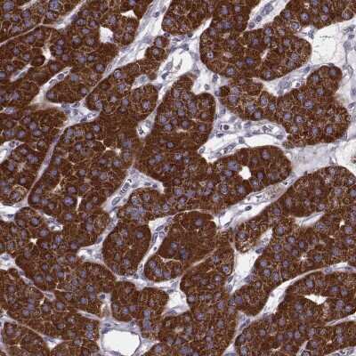 Immunohistochemistry: FAM8A1 Antibody [NBP2-68965] - Immunohistochemical staining of human parathyroid gland shows strong positivity in glandular cells.