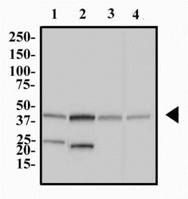 Western Blot: FAM8A1 Antibody [NBP2-47125] - Western Blot Image of anti-FAM8A1. Total protein from human brain (lane 1), skeletal muscle (lane 2), mouse brain (lane 3) and rat testis (lane 4) was separated on a 12% gel by SDS-PAGE, transferred to PVDF membrane and blocked in 5% non-fat milk in TBST. The membrane was probed with 2.0 ug/ml anti-FAM8A1 in 1% milk and detected with an anti-rabbit HRP secondary antibody using chemiluminescence. 