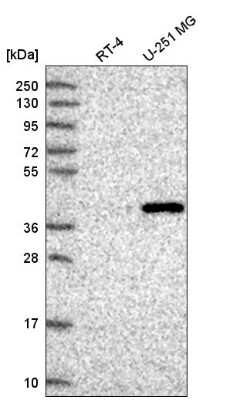 Western Blot: FAM8A1 Antibody [NBP2-58571] - Western blot analysis in human cell line RT-4 and human cell line U-251 MG.